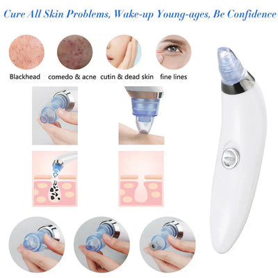 Gawadar Import™ 4 in 1 Derma Blackhead Remover Machine